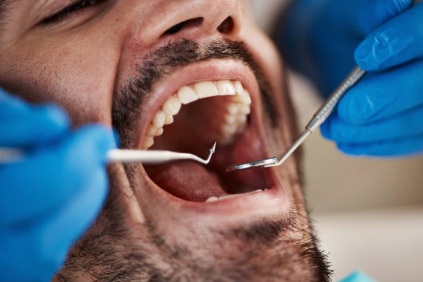 TMJ/TMD Treatment in Nesquehoning, PA